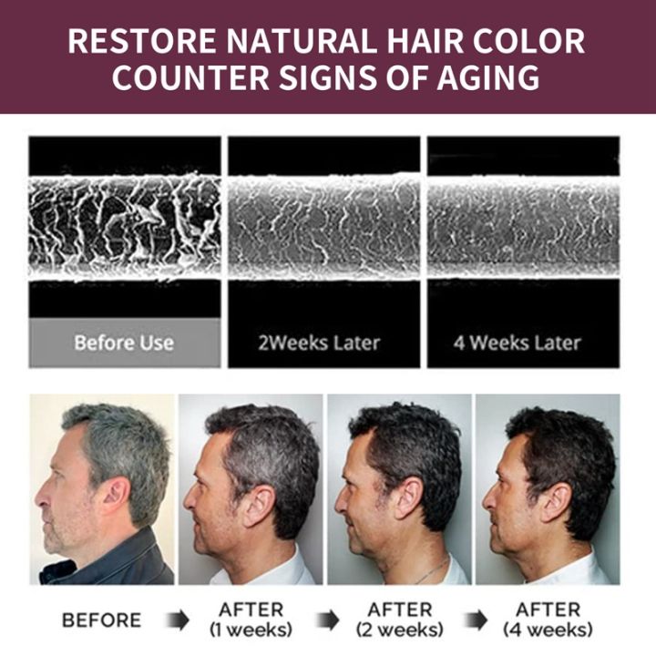 South%20Moon%20Rice%20Shampoo%20Soap%20Korea%20Polygonum%20Darkening%20Root%20Scalp%20Deep%20Clean%20Anti%20Loss%20Prevent%20Hair%20Color%20Restore%20Nourishing%20Care%20Polygonum%20Soap%20Anti%20Hair%20Loss%20Bar%20Restore%20Nutrition%20Regrowth%20White%20To%20Black%20Solid%20Shampoo%20-%20Image%207