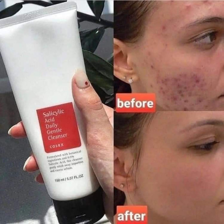COSRX%20Salicylic%20Acid%20Daily%20Gentle%20Cleanser%20-%20Face%20Wash-150ml%20-%20Image%206