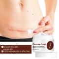Scar Healing Cream 30g Effective Anti Scarring Cream Healing Scar Cream Protective Scar Remover Natural Body Cream For Scars BruberryBeE.