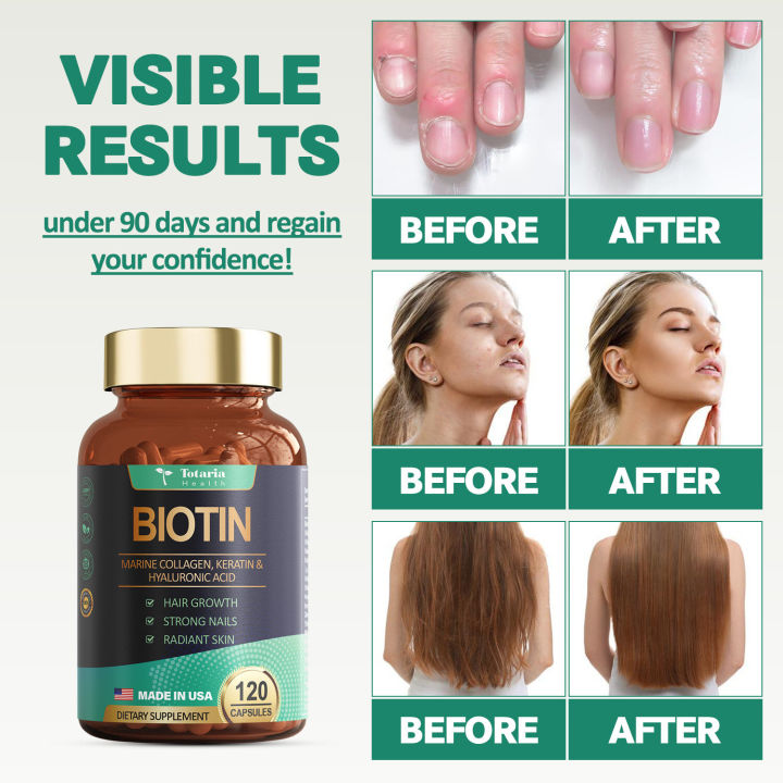 Totaria%20Biotin%20Hair%20Support%20for%20Women%20High%20Absorption%20%E2%80%93%20Supports%20Healthy%20Hair,%20Skin%20&%20Nails%20120%20Capsules%20-%20Image%207