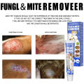 Treatment Ringworm Mites Anti-Itch Cream Fight Ringworm Infections For.