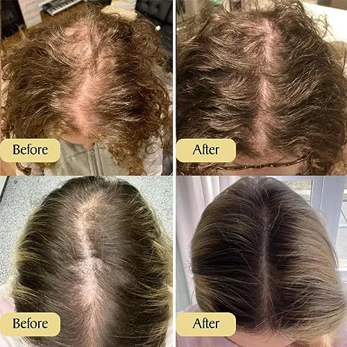 %E8%B7%A8%E5%A2%83%E4%B8%93%E4%BE%9Bveganic%20hair%20oil%E6%8A%A4%E5%8F%91%E7%B2%BE%E6%B2%B9%20%E6%BB%8B%E6%B6%A6%E4%BF%AE%E6%8A%A4%E7%BB%86%E8%85%BB%E6%9F%94%E9%A1%BA%E6%8A%A4%E5%8F%91%E7%B2%BE%E6%B2%B9%20-%20Image%202