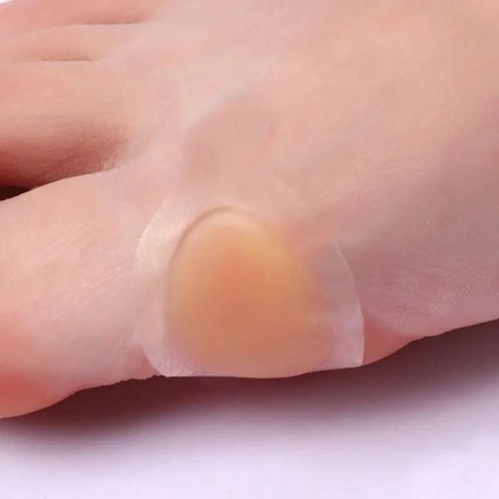 4Pcs/Box%20Blister%20Bandages%20Waterproof%20Hydrocolloid%20Plaster%20Adhesive%20Anti-Wearing%20Heel%20Gel%20Sticker%20Pain%20Relief%20Pedicure%20Patch%20Pads%20-%20Image%205
