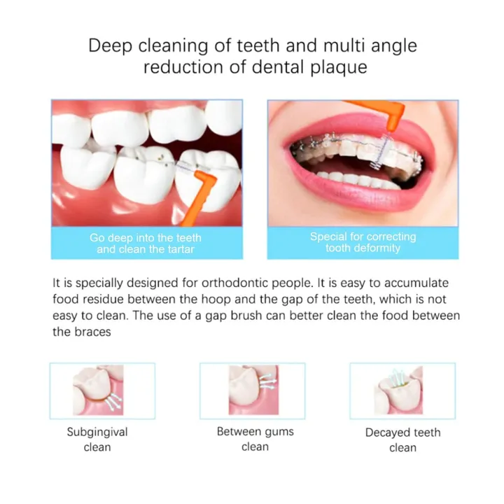 Posh%20inspired-premium%20Quality-5pc/box%20push-pull%20Interdental%20Brush%20Oral%20Care%20Teeth%20whitening%20Dental%20tooth%20Brush%20-%20Innovative%20Desigh%20-%20Image%202