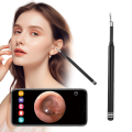 Smart Visual Ear Cleaner 5.5mm 3-in-1 Ear Otoscope Earwax Remover Picker USB C Charging Endoscope MIni Camera Health. 
