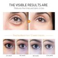 New Anti-Wrinkle Eye Cream Fades Fine Lines Anti Dark Circles Eye Serum Remove Eye Bags Puffiness Anti-Aging Firmness Eye Care. 