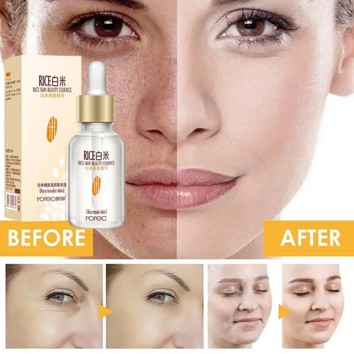 White%20Rice%20face%20Serum%20skin%20care%20-Wrinkles%20Dark%20Spots%20&%20anti-aging%20Sun%20Damage%20Corrector-15ml%20-%20Image%204