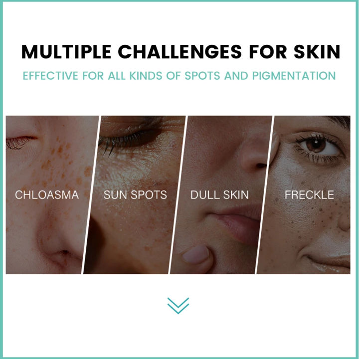 Sumifun%20Melasma%20Relief%20Cream%2020g%20%E2%80%93%20Dark%20Spot%20Remover%20&%20Brightening%20Cream%20%7C%20Helps%20Reduce%20Melasma,%20Sun%20Spots,%20Freckles%20&%20Pigmentation%20%7C%20Herbal%20Nourishing%20Skin%20Care%20-%20Image%205