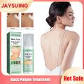 Back Acne Repair Spray Anti Pimples Marks Acne Spots Removal Oil Control Body Whitening Exfoliating Back Pimple Treatment Spray. 