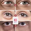 Micro-needle Eye Patch Hyaluronic Remove Dark Circles Eye Bags Improve Puffiness Lift Firm Whitening Moisturizing Skin. 