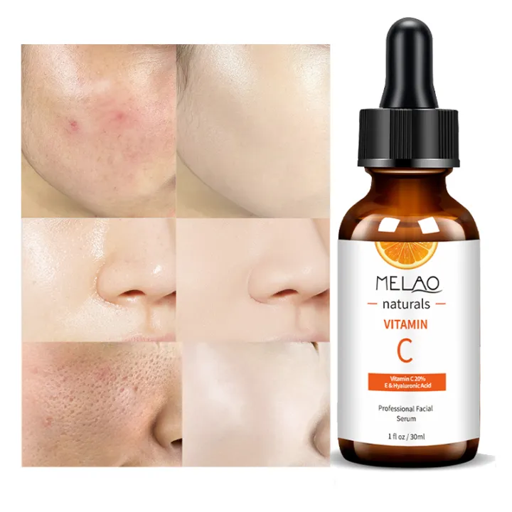 MELAO%20private%20label%20anti%20wrinkle%20Vitamin%20C%20Serum%20-%20Image%204