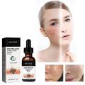 Melanin Correcting Facial Serum Dark Spot Corrector Remover Skin Care Moisturizing Repair Serum Hyaluronic Acid Vitamin C Serum. 