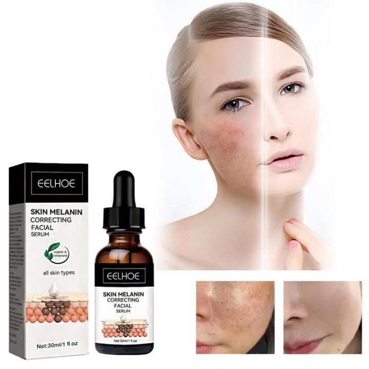 Melanin%20Correcting%20Facial%20Serum%20Dark%20Spot%20Corrector%20Remover%20Skin%20Care%20Moisturizing%20Repair%20Serum%20Hyaluronic%20Acid%20Vitamin%20C%20Serum%20-%20Image%203