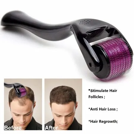 Derma%20Roller%200.5%20Mm%20For%20Hair%20Growth%20-%20Black%20Head%20Remover%20-%20Derma%20Roller%20-%20Image%205