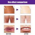 Lightening Cream Dark Neck Lightening Cream Brightens And Moisturizes For Intimate Areas Armpit Neck Back Legs Elbows.
