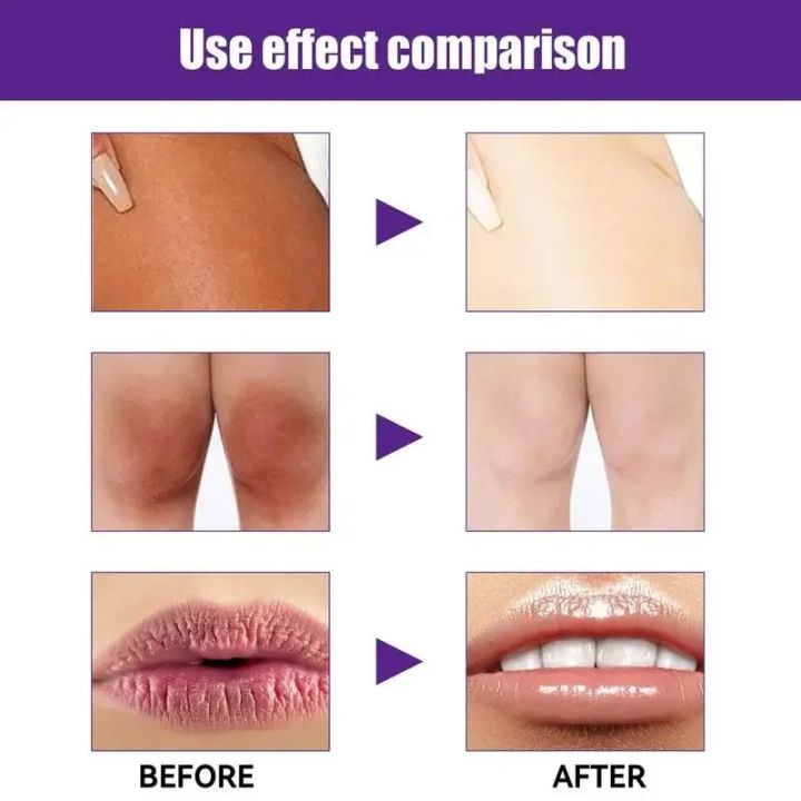 Lightening%20Cream%20Dark%20Neck%20Lightening%20Cream%20Brightens%20And%20Moisturizes%20For%20Intimate%20Areas%20Armpit%20Neck%20Back%20Legs%20Elbows%20-%20Image%202