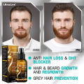 Anti Hair Loss Serum Fast Hair Growth Spray Products Prevent Baldness Treatment Scalp Dry Damaged Beard Hair Care Essential Oils. 