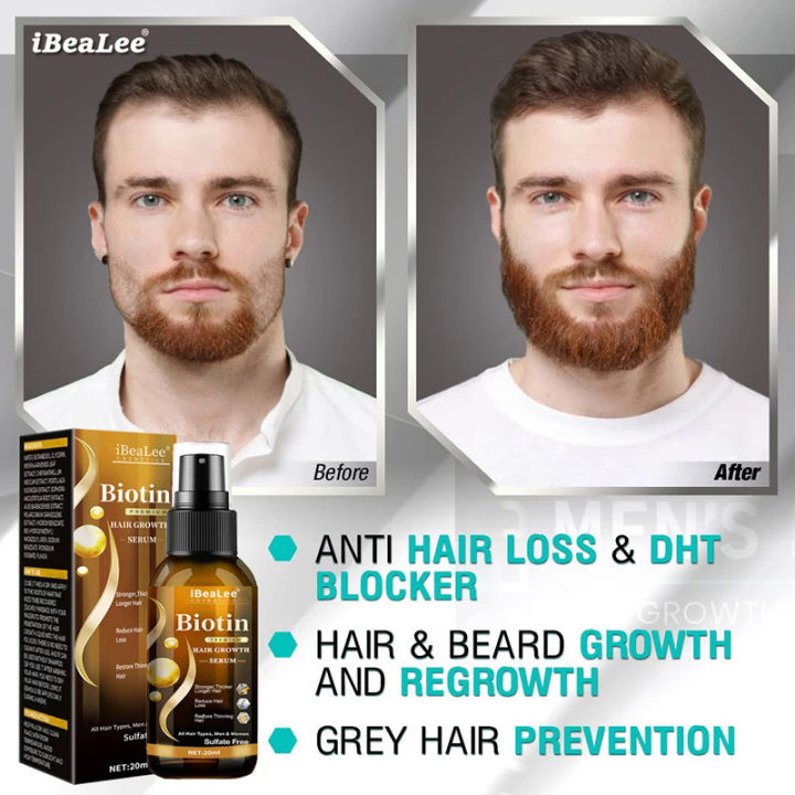 Anti%20Hair%20Loss%20Serum%20Fast%20Hair%20Growth%20Spray%20Products%20Prevent%20Baldness%20Treatment%20Scalp%20Dry%20Damaged%20Beard%20Hair%20Care%20Essential%20Oils%20-%20Image%202