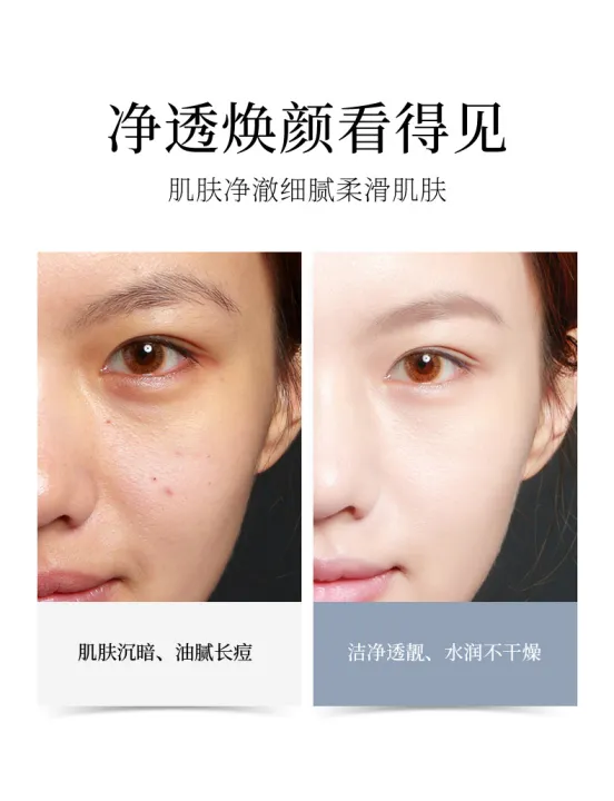 Acne%20Clear%20Face%20Wash%20Anti%20Acne%20&%20oil%20control%20%2060g%20-%20Image%202