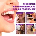 SP-7 Probiotic Toothpaste, Yayashi Sp-7 Toothpaste Whitening. 