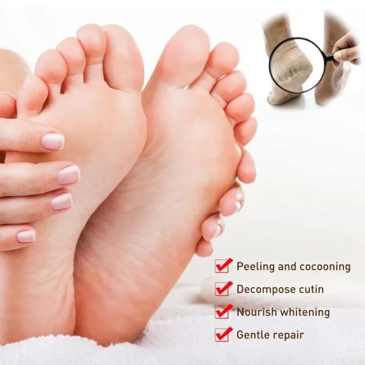 Foot%20Massage%20Exfoliating%20Cream%20Heels%20Anti-Drying%20Peeling%20Cracked%20Feet%20Care%20Moisturizing%20Exfoliation%20remove%20Dead%20Skin%20Foot%20Cream%20-%20Image%202