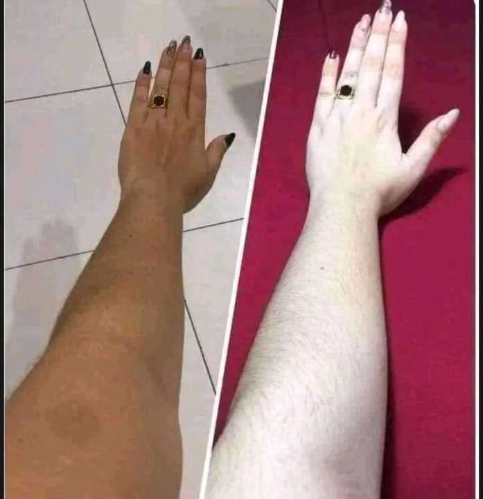 Kem%20Cot%20Thai%20Emergency%20Whitening%20Body%20Cream%20-%20300gm%20-%20Image%208