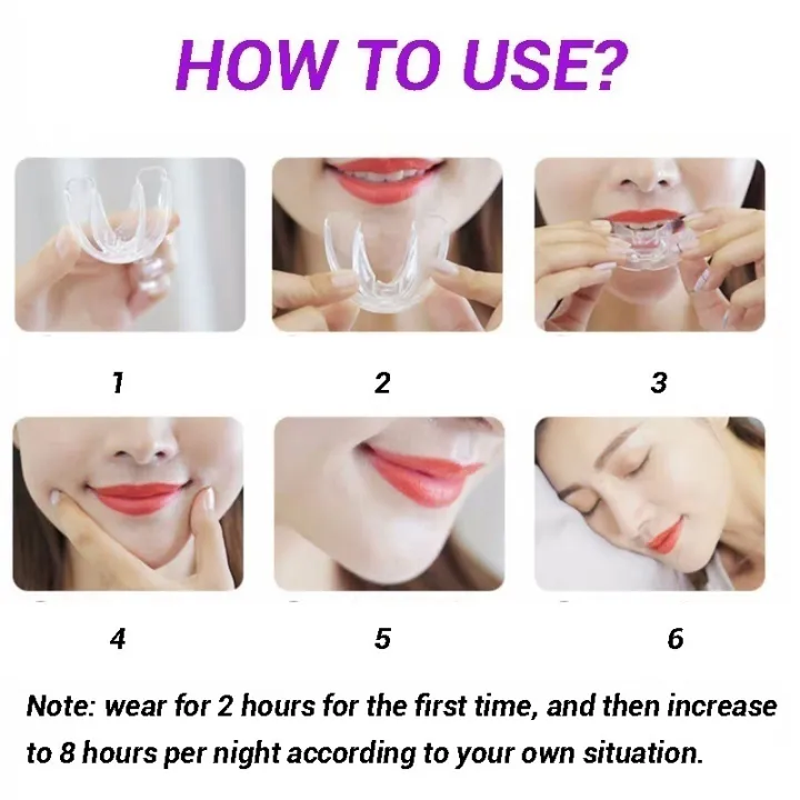 Dental%20Orthodontic%20Teeth%20Corrector%20Braces%20Retainer%20Straighten%20Tools%20Tooth%20Care%20Fullhouse%20-%20Image%207