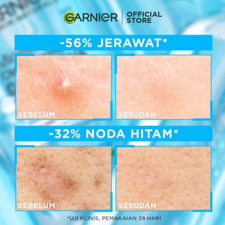 Garnier%20Skin%20Naturals%20Micellar%20Cleansing%20Water%20Salicylic%20BHA%20125ml%20-%20Image%205