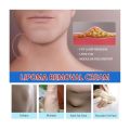South Moon Lipoma Removal Cream Lipolysis Fat Lump Relieve Plaster Skin Swelling Ointment Subcutaneous Lumps Dredge Dissipate Body Care.