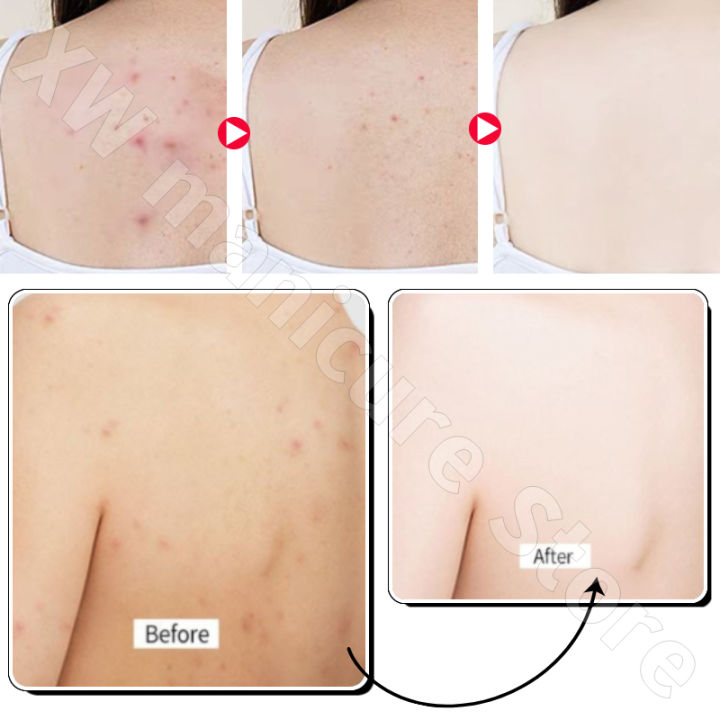 400ML%20Vaseline%20Body%20Lotion%20for%20Men%20and%20Women%20Moisturizing%20Body%20Moisturizing%20Fragrance%20Brightening%20Skin%20Exfoliating%20Body%20Lotion%20-%20Image%202