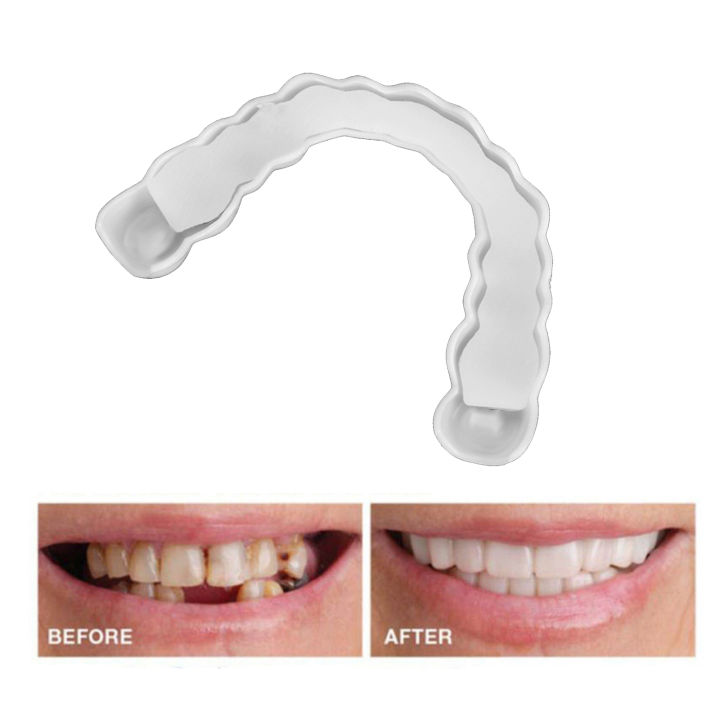 Denture%20Teeth%20Whitening%20Snap%20Bottom%20False%20Teeth%20Cover%20Veneers%20Tooth%20Cover%20White%20Fit%20Snap%20On%20Silicone%20Beauty%20Cosmetic%20Teeth%20FeeoiF%20-%20Image%203