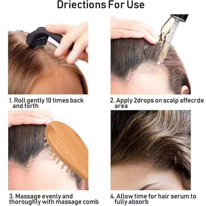 Kirkland%20Minoxidil%205%25%20Topical%20Solution%20Extra%20Strength%20Beard%20&%20Hair%20Regrowth%20Treatment%2060ml%201%20Month%20Supply%20-%20100%25%20Original%20-%20MNXMC%20-%20Image%208