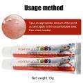 15g Chinese Medicine Psoriasis Ointment Treat Fungal Dermatitis Antipruritic Dressing Skim Eczema Antibacterial Repair Ointment. 