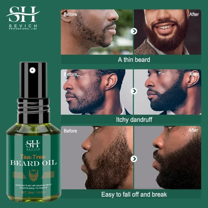 Men%20Beard%20Growth%20Oil%20100%25%20Natural%20Beard%20Growth%20Essential%20Hair%20Growth%20Nourishing%20Shampoo%20Moisturizing%20Smoothing%20Beard%20Conditioner%20-%20Image%202
