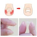 Ingrown Toenail Correction Tool Set Ingrown Toe Nail Pedicure Elastic Patch Straightening Clip Brace with Glue Foot Care Kit New. 