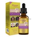 DISAAR BEAUTY Natural Hair Growth Serum, Ginger Essential Oil, Hair Growth Oil, Anti Hair Loss Essence, Hair Thinning Treatment, Healthy Strong Thick Hair, Treats Baldness Weak Brittle Thinning Hair. 