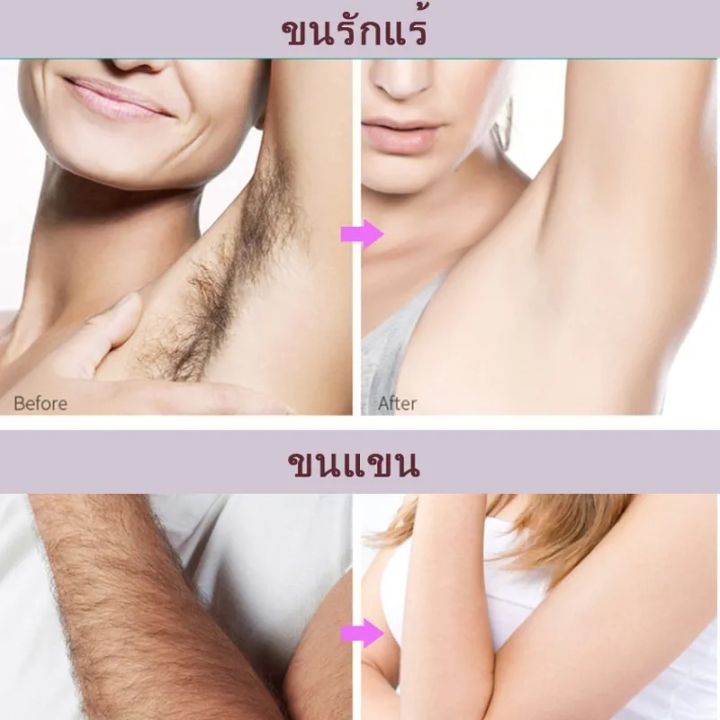 Kingyes%20Silky%20Beauty%20Painless%20Hair%20Removal%20Spray%20For%20Men%20&%20Women%20150ML%20-%20Image%205