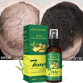 Organic Ginger Oil China Ginger Hair Growth Serum Sprayer Fast Hair Growth Dense Regrowth Ginger Serum Oil Natural Hair Growth Accelerator For Stronger. 