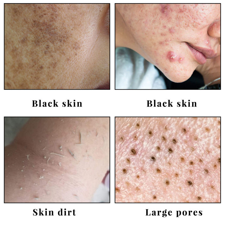 Kojic%20Acid%20Skin%20Care%20Set%20Facial%20Cleanser%20Body%20Lotion%20Handmade%20Soap%20Remove%20Dark%20Spots%20Whitening%20Anti%20Aging%20Remove%20Acne%20Body%20Care%20-%20Image%203
