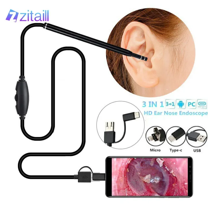USB%20Otoscope-Ear%20Endoscope%20Diameter%20Visu%20Waterproof%20HD%20Ear%20Camera%20with%20Ear%20Tool%20and%206%20Adjustable%20LED%20Lights%20for%20-Android%20and%20Windows%20-%20Image%207