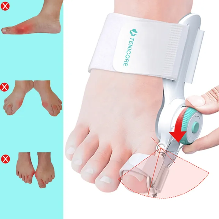 Bunion%20Corrector%20Unisex%20Foot%20Hallux%20Valgus%20Braces%20Rotatable%20with%20Knob%20Toe%20Separator%20Straightener%20Adjustable%20for%20Pedicure%20-%20Image%202