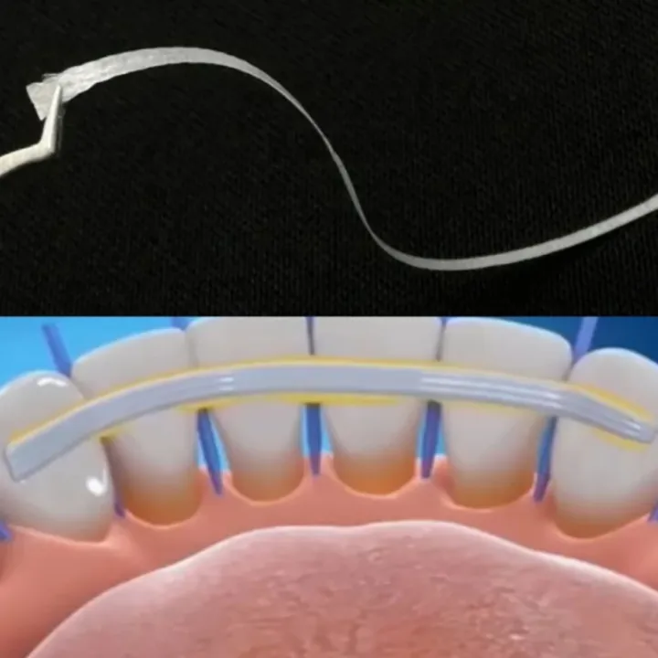 %E3%80%90Must-Have%20Accessories%E3%80%91%207Pcs/Box%20Dental%20Material%20Flexible%20Fiber%20Strip%20Splint%20Loose%20Tooth%20Fixation%20Strips%20Light%20Cure%20Bonding%20Orthodontic%20Retainers%20-%20Image%206