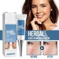 Pimple Removal Cream Effective Zit Scar Ointment For Face Spot Treat Removal Of Blackheads Whiteheads Cystic Pimples Zits. 