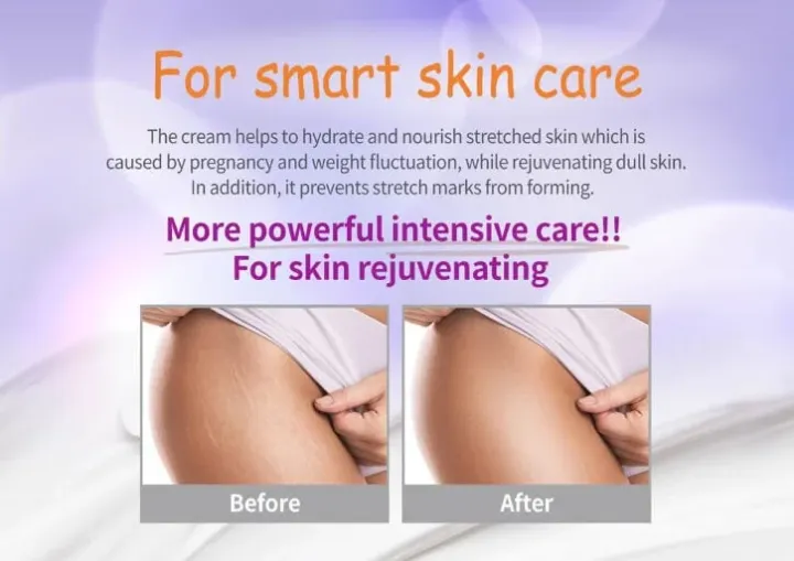 Pax%20Moly%20Mom%E2%80%99s%20Care%20Stretch%20Mark%20Cream%20-70ml%20-%20Image%204