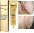 LANBENA TCM scar and Acne Spot Removal Gel Ointment. 