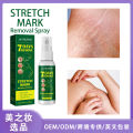 Jaysuing Pregnancy Repair Spray Fade Pregnant Women Pregnancy Fine Lines Postpartum Skin Pregnancy Lines Care Spray. 