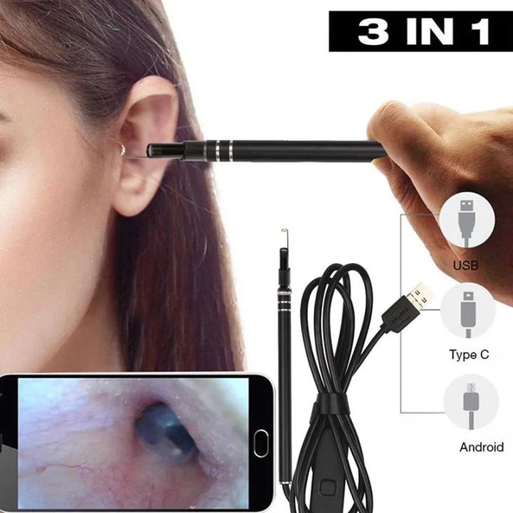 【All Of Me】Ear Otoscope Megapixels Ear Scope Camera Ear Digital Endoscope Earwax Tool with 6led