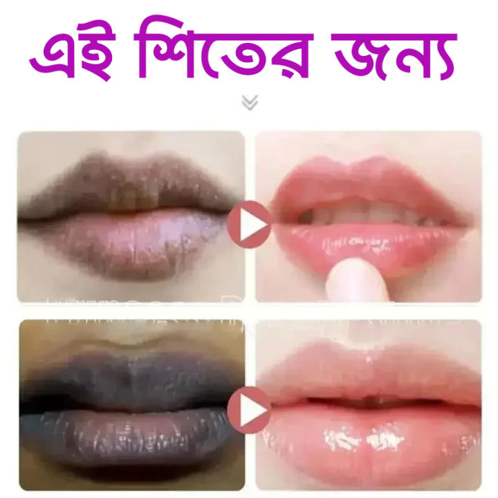 ELHOE%20Baby%20Pink%20Drop:%20Best%20Lip,%20Nipple%20&%20Skin%20Whitening%20Serum.%20Get%20a%20Natural%20Rosy%20Pink%20Glow%20for%20Lips%20&%20Nipples.%20Buy%20Now%20-%20Image%203