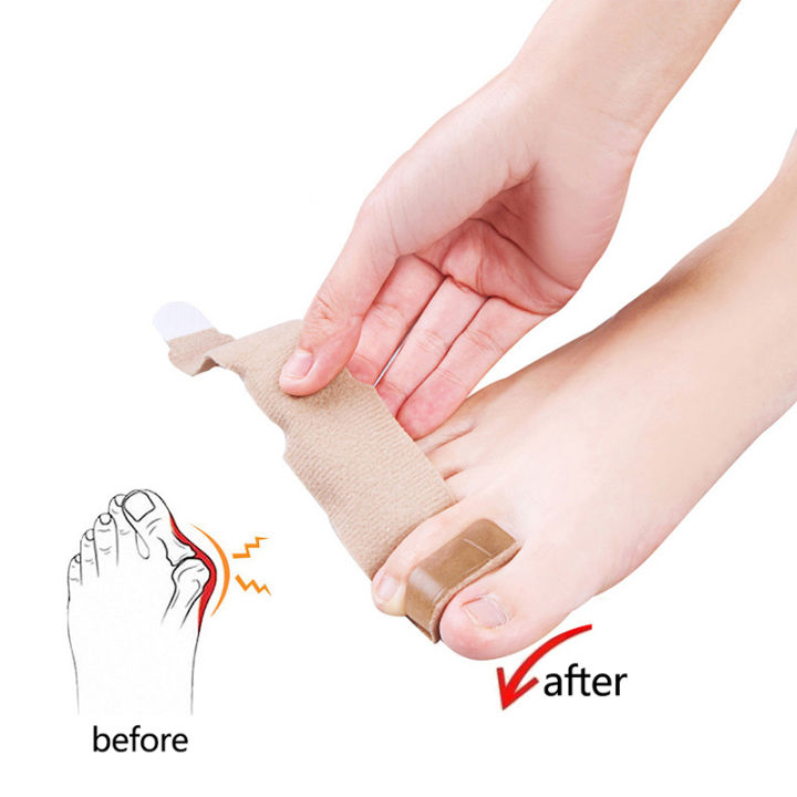 1PC%20Toe%20Wraps%20Bunion%20Corrector%20Splint%20for%20Broken%20Toe%20Gel%20Buddy%20Tape%20Big%20Toe%20Separators%20Bandages%20Brace%20for%20Overlapping%20Toes%20Huiye%20-%20Image%204