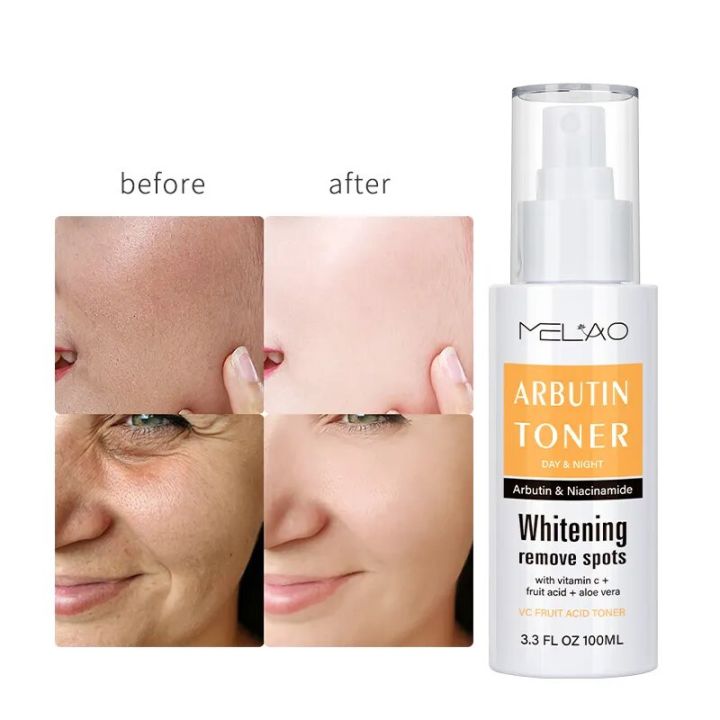 Melao Moisturizing Mist Vitamin C Whitening Arbutin Toner- & Spots Remover